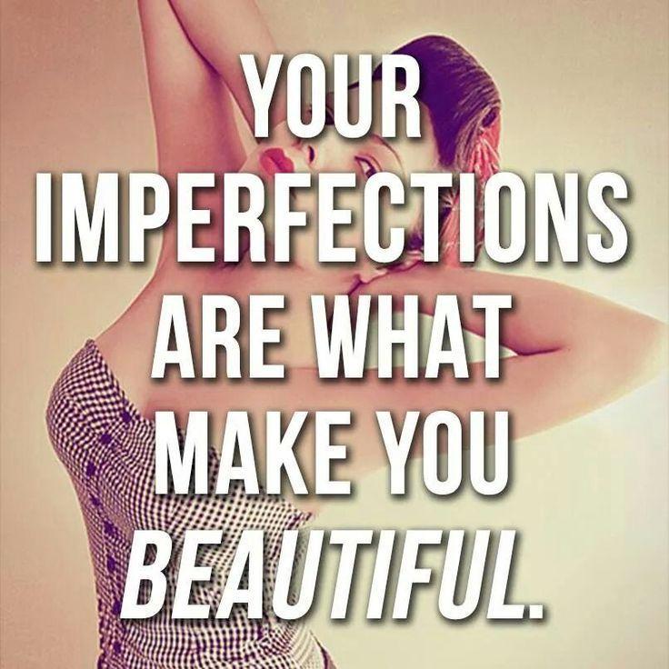 Imperfections are what make you beautiful Picture Quote #1