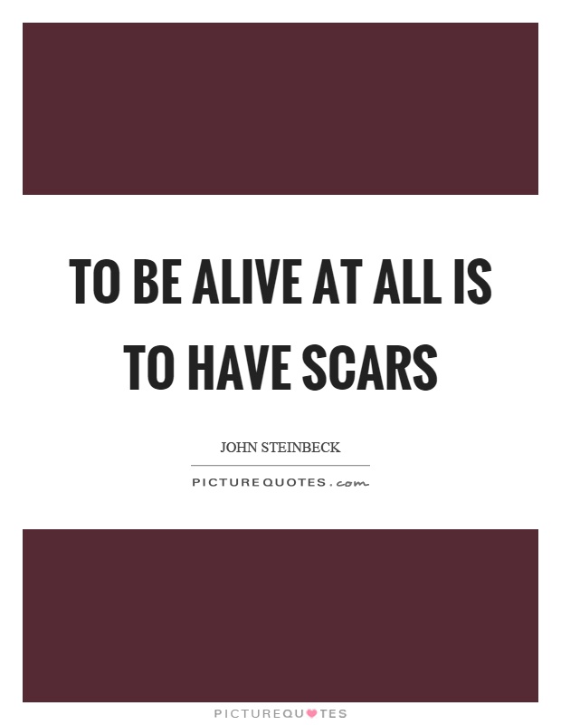 To be alive at all is to have scars Picture Quote #1