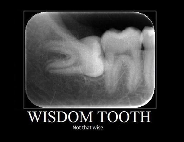 Wisdom tooth. Not that wise Picture Quote #1