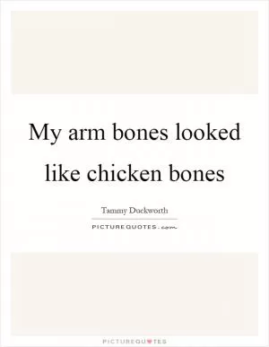 My arm bones looked like chicken bones Picture Quote #1