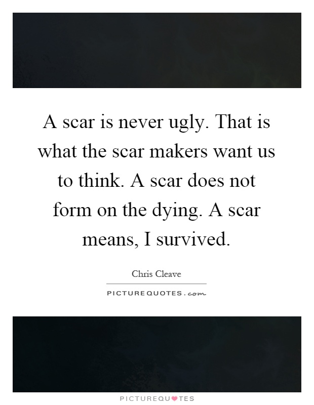 A scar is never ugly. That is what the scar makers want us to think. A scar does not form on the dying. A scar means, I survived Picture Quote #1