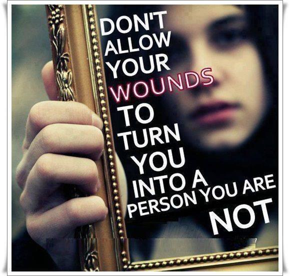 Don't allow your wounds to turn you into a person you are not Picture Quote #1