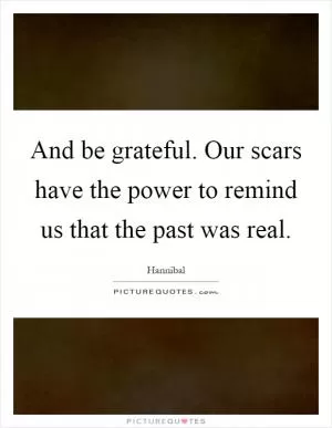 And be grateful. Our scars have the power to remind us that the past was real Picture Quote #1