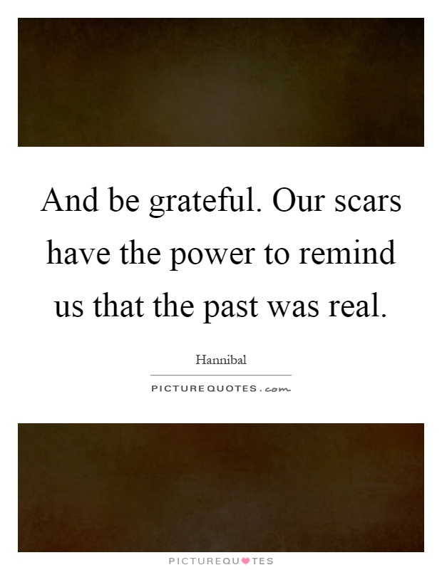 And be grateful. Our scars have the power to remind us that the past was real Picture Quote #1