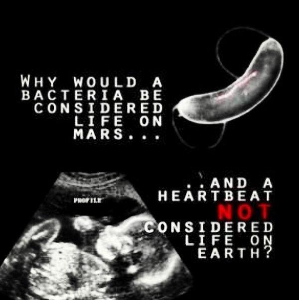 Why would a bacteria be considered life on Mars... and a heartbeat not considered life on Earth? Picture Quote #1