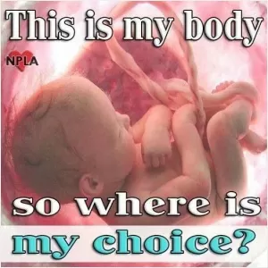This is my body so where is my choice? Picture Quote #1