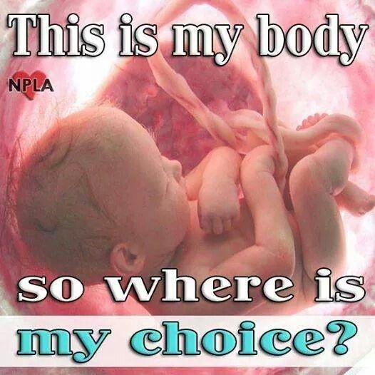 This is my body so where is my choice? Picture Quote #1