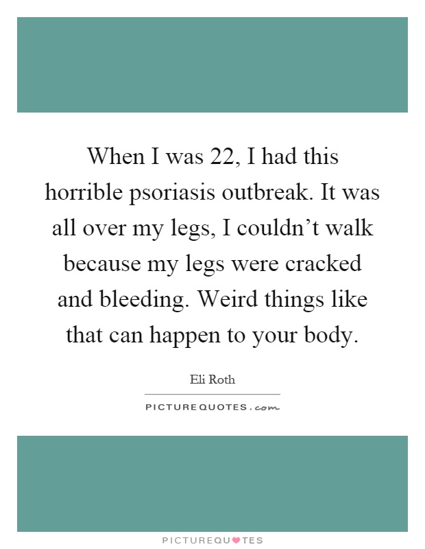 When I was 22, I had this horrible psoriasis outbreak. It was all over my legs, I couldn't walk because my legs were cracked and bleeding. Weird things like that can happen to your body Picture Quote #1