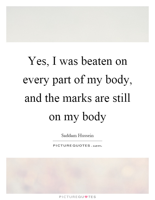 Yes, I was beaten on every part of my body, and the marks are still on my body Picture Quote #1
