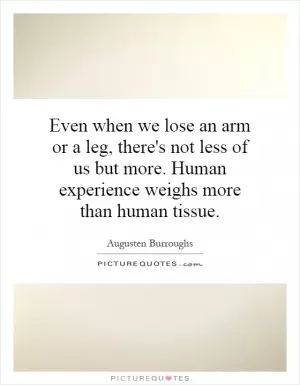 Even when we lose an arm or a leg, there's not less of us but more. Human experience weighs more than human tissue Picture Quote #1