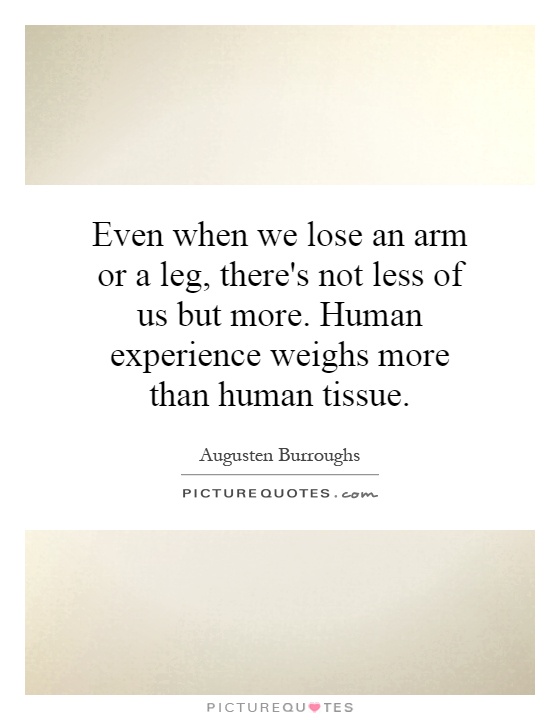 Even when we lose an arm or a leg, there's not less of us but more. Human experience weighs more than human tissue Picture Quote #1