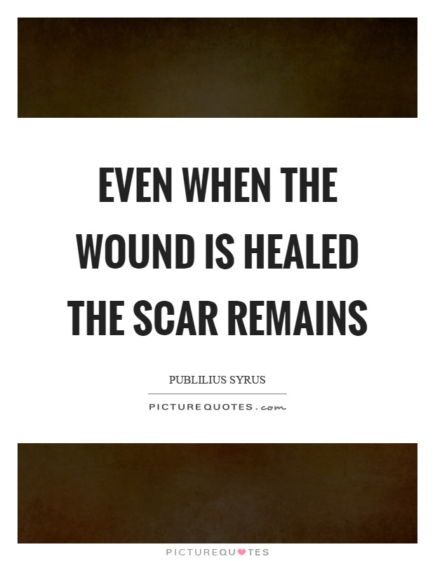 Even when the wound is healed the scar remains Picture Quote #1