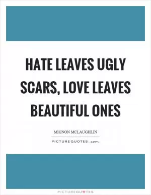 Hate leaves ugly scars, love leaves beautiful ones Picture Quote #1