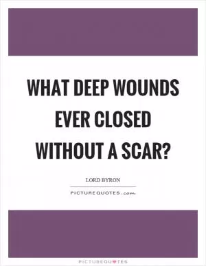 What deep wounds ever closed without a scar? Picture Quote #1