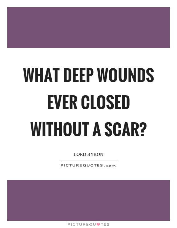 What deep wounds ever closed without a scar? Picture Quote #1