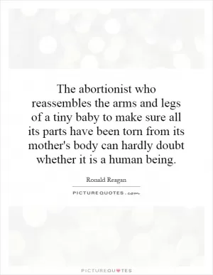 The abortionist who reassembles the arms and legs of a tiny baby to make sure all its parts have been torn from its mother's body can hardly doubt whether it is a human being Picture Quote #1