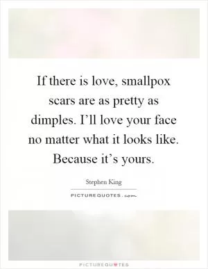 If there is love, smallpox scars are as pretty as dimples. I’ll love your face no matter what it looks like. Because it’s yours Picture Quote #1