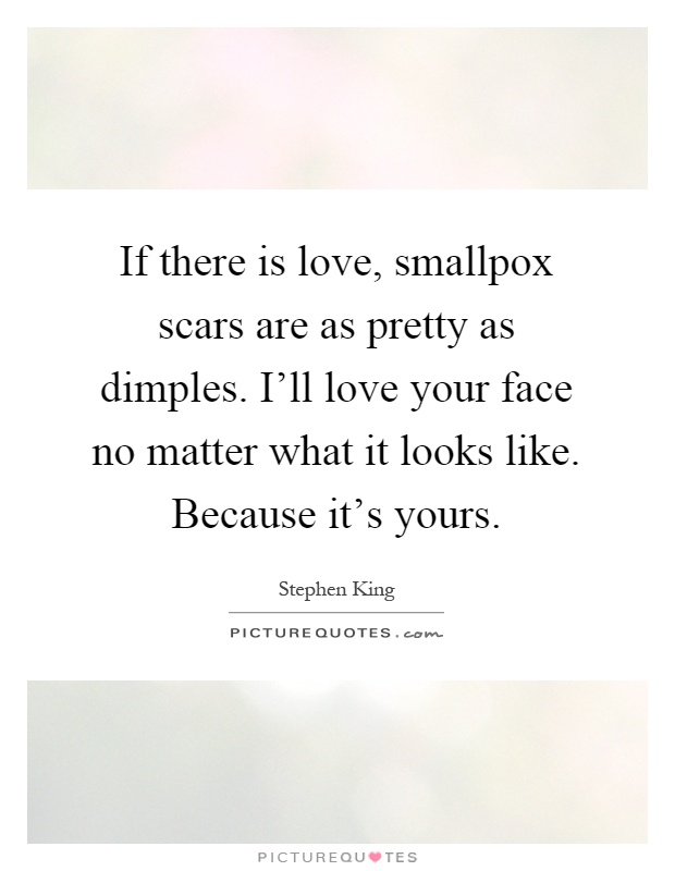 If there is love, smallpox scars are as pretty as dimples. I'll love your face no matter what it looks like. Because it's yours Picture Quote #1