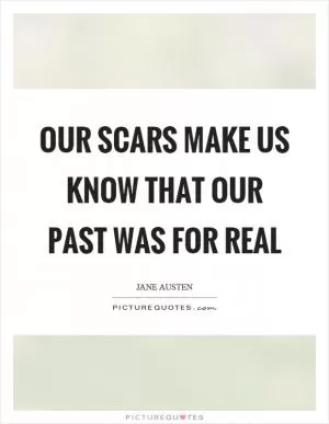 Our scars make us know that our past was for real Picture Quote #1