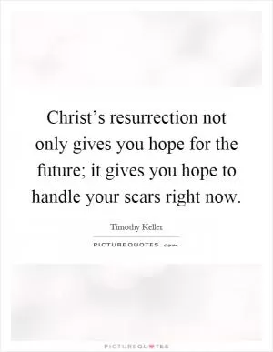Christ’s resurrection not only gives you hope for the future; it gives you hope to handle your scars right now Picture Quote #1