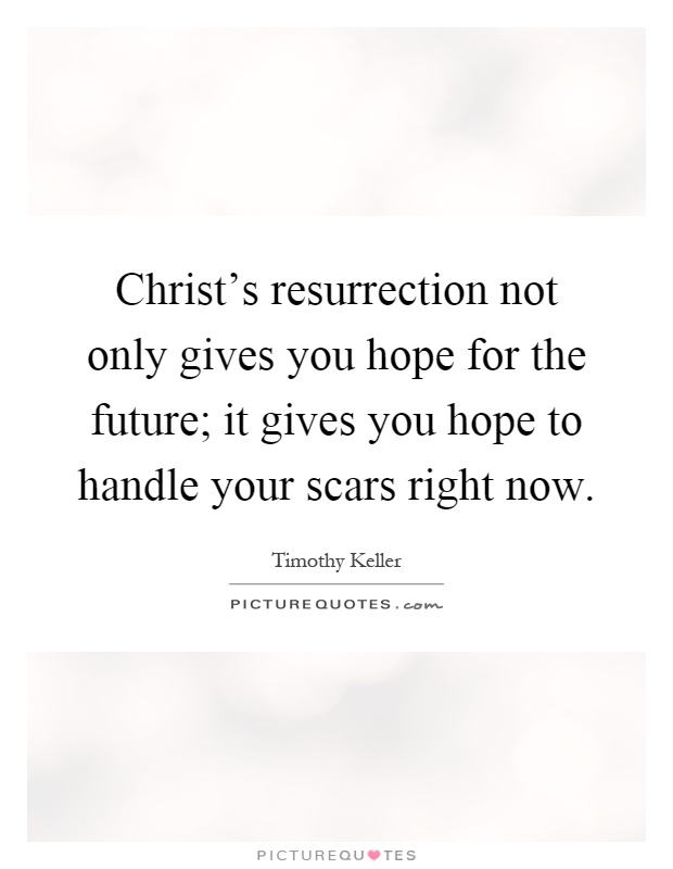 Christ's resurrection not only gives you hope for the future; it gives you hope to handle your scars right now Picture Quote #1