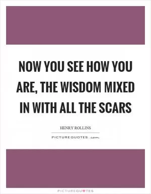 Now you see how you are, the wisdom mixed in with all the scars Picture Quote #1