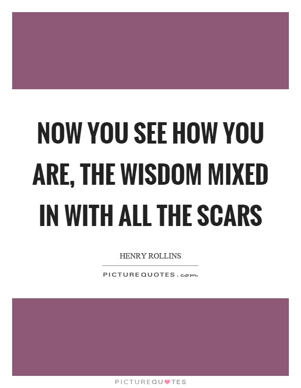 Now you see how you are, the wisdom mixed in with all the scars Picture Quote #1