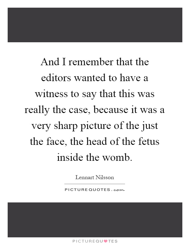 And I remember that the editors wanted to have a witness to say that this was really the case, because it was a very sharp picture of the just the face, the head of the fetus inside the womb Picture Quote #1