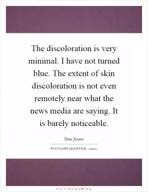 The discoloration is very minimal. I have not turned blue. The extent of skin discoloration is not even remotely near what the news media are saying. It is barely noticeable Picture Quote #1
