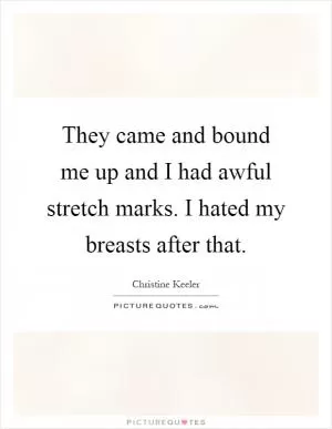 They came and bound me up and I had awful stretch marks. I hated my breasts after that Picture Quote #1