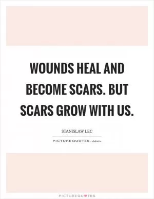 Wounds heal and become scars. But scars grow with us Picture Quote #1