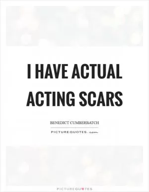 I have actual acting scars Picture Quote #1