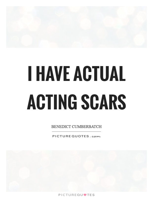 I have actual acting scars Picture Quote #1