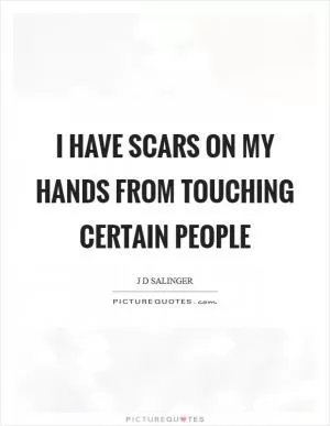 I have scars on my hands from touching certain people Picture Quote #1