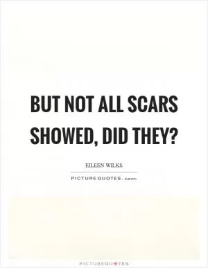 But not all scars showed, did they? Picture Quote #1