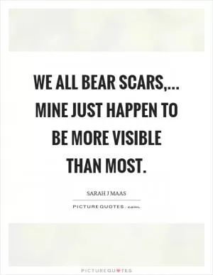 We all bear scars,... Mine just happen to be more visible than most Picture Quote #1