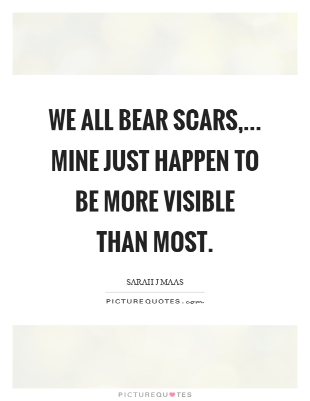 We all bear scars,... Mine just happen to be more visible than most Picture Quote #1