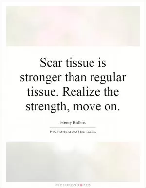 Scar tissue is stronger than regular tissue. Realize the strength, move on Picture Quote #1
