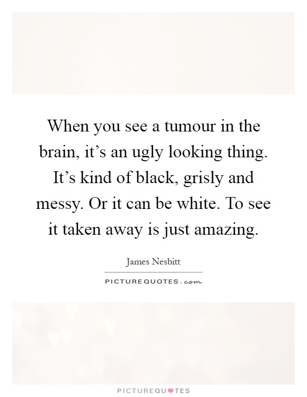 When you see a tumour in the brain, it's an ugly looking thing. It's kind of black, grisly and messy. Or it can be white. To see it taken away is just amazing Picture Quote #1