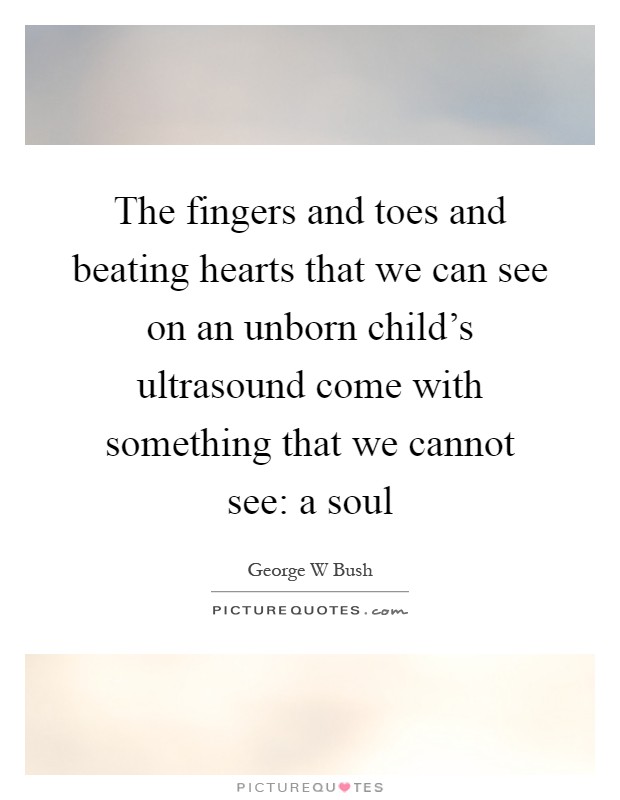 The fingers and toes and beating hearts that we can see on an unborn child's ultrasound come with something that we cannot see: a soul Picture Quote #1