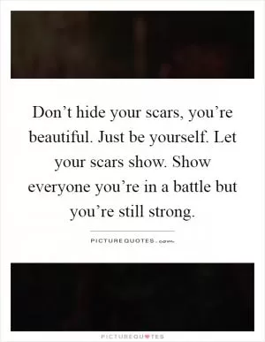 Don’t hide your scars, you’re beautiful. Just be yourself. Let your scars show. Show everyone you’re in a battle but you’re still strong Picture Quote #1
