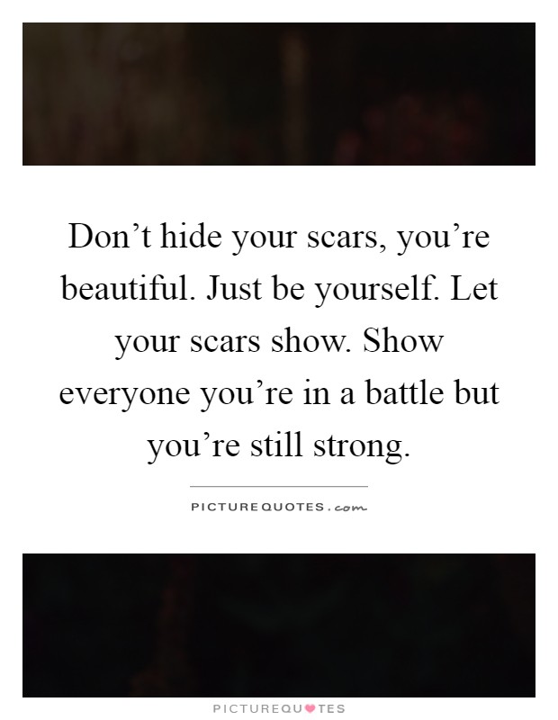 Don't hide your scars, you're beautiful. Just be yourself. Let your scars show. Show everyone you're in a battle but you're still strong Picture Quote #1