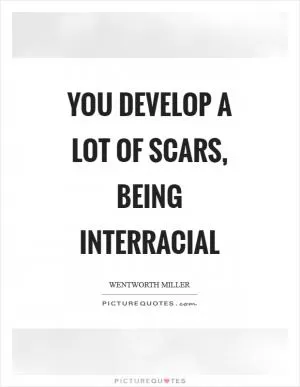 You develop a lot of scars, being interracial Picture Quote #1