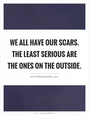 We all have our scars. The least serious are the ones on the outside Picture Quote #1