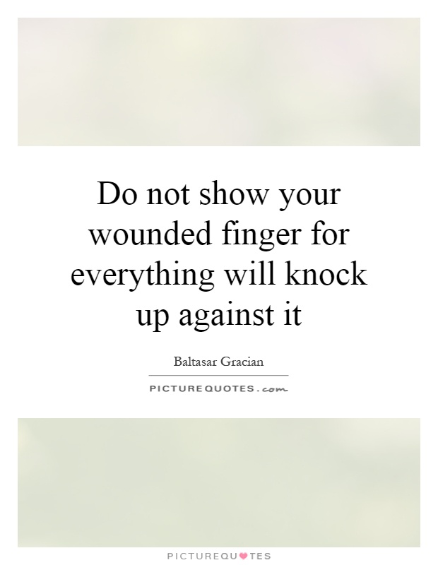 Do not show your wounded finger for everything will knock up against it Picture Quote #1