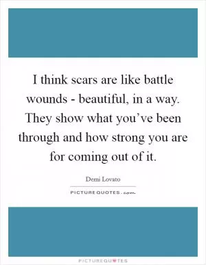 I think scars are like battle wounds - beautiful, in a way. They show what you’ve been through and how strong you are for coming out of it Picture Quote #1