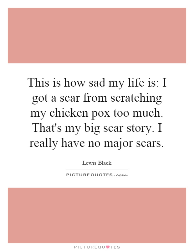 This is how sad my life is: I got a scar from scratching my chicken pox too much. That's my big scar story. I really have no major scars Picture Quote #1