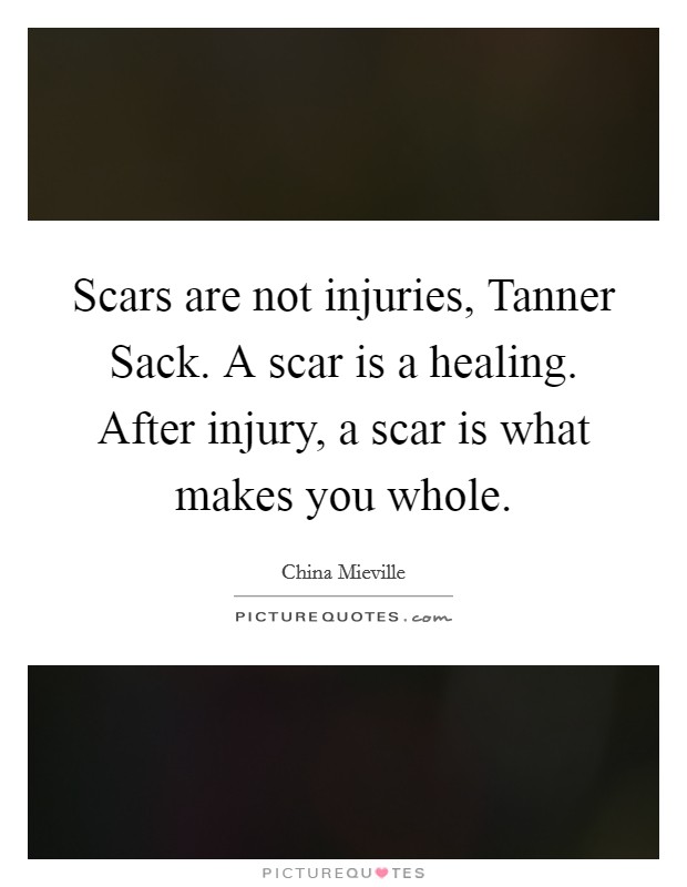 Scars are not injuries, Tanner Sack. A scar is a healing. After injury, a scar is what makes you whole Picture Quote #1