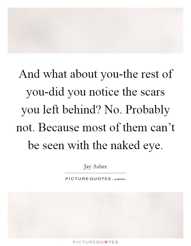 And what about you-the rest of you-did you notice the scars you left behind? No. Probably not. Because most of them can't be seen with the naked eye Picture Quote #1