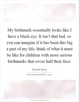My birthmark essentially looks like I have a black eye. It isn’t that bad, so you can imagine if it has been this big a part of my life, think of what it must be like for children with more serious birthmarks that cover half their face Picture Quote #1